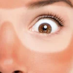 10 Proven Tips for removing Tan
