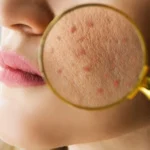 Anti pollution skincare
