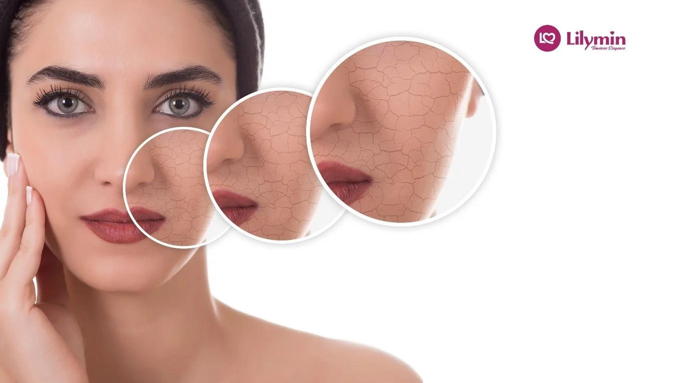 Best Sunscreen for Dry Skin in India